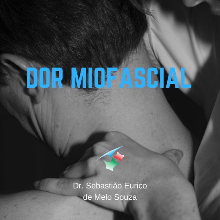 Dor Miofascial Dr Sebastião Eurico De Melo Souza 0975
